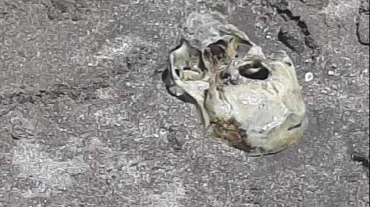 Cráneo hallado en Mar del Plata
